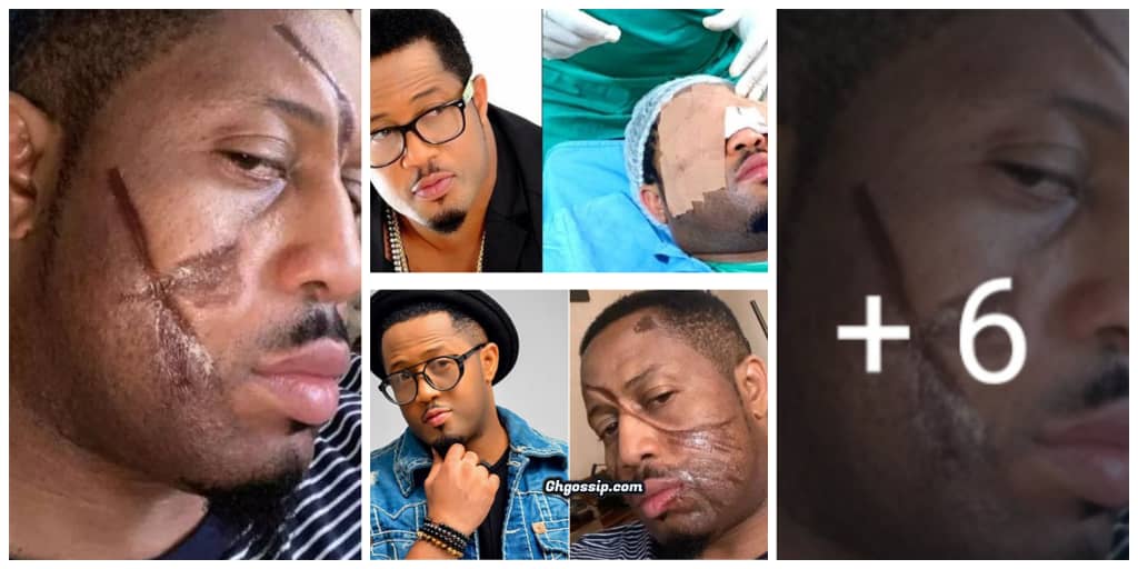 Nollywood Actor Mike Ezuruonye recounts how he escaped ‘permanent blindness’, calls for prayers